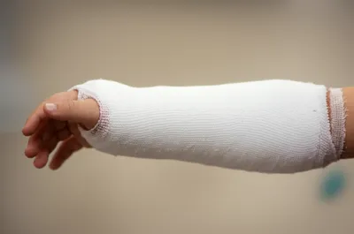 Illustration plaster - Image 1