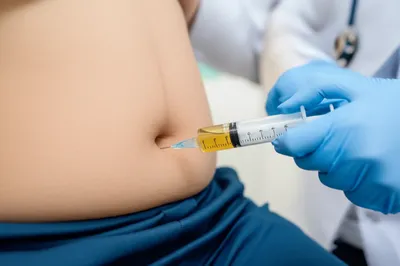 Illustration tap - Image 1