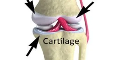 Illustration cartilage - Image 2