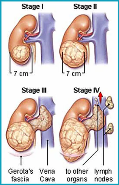 Illustration staging - Image 2
