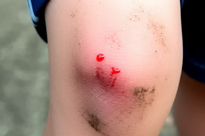 Illustration bleeding