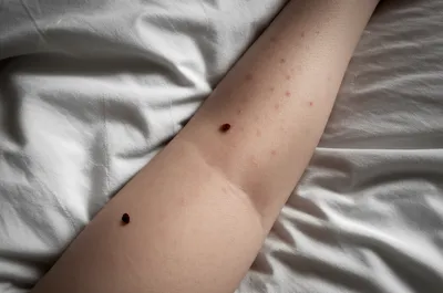 Illustration chinches - Image 1