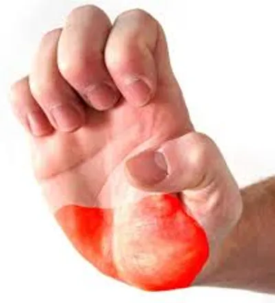 Illustration heel - Image 3