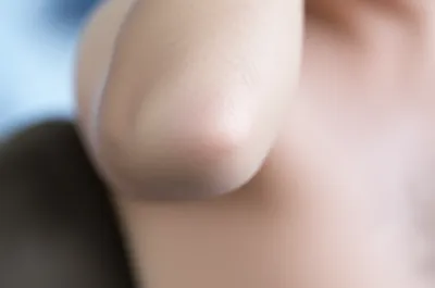 Illustration anal - Image 1