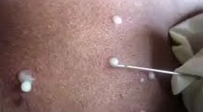 Illustration lance - Image 3