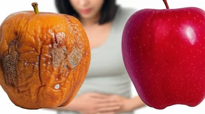 Illustration worse - Image 1