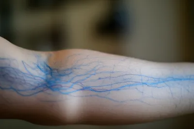 Illustration venous - Image 1