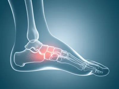 Illustration tarse - Image 1