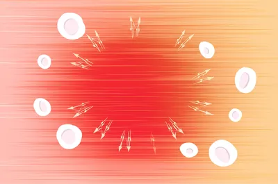 Illustration inflammatory - Image 1