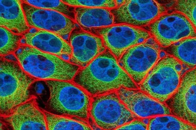 Illustration stains - Image 1