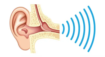 Illustration acoustic - Image 1