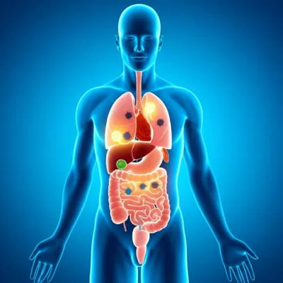 Illustration chemotherapy