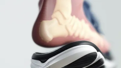 Illustration heel - Image 1