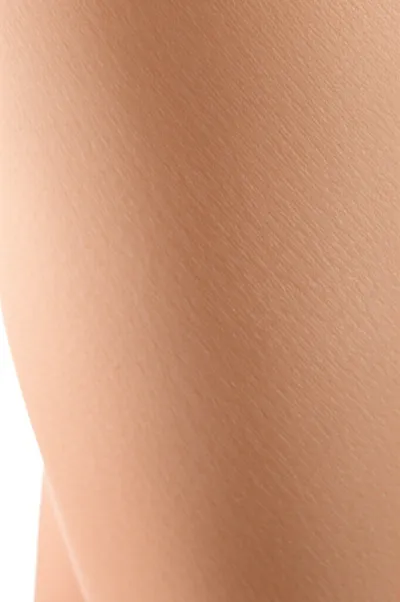 Illustration cellulite