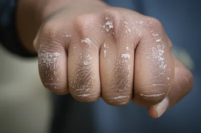 Illustration chapped - Image 1