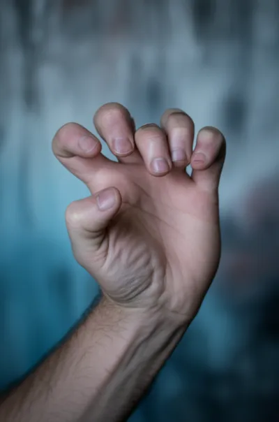 Illustration contracture