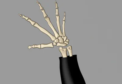 Illustration dislocation - Image 1