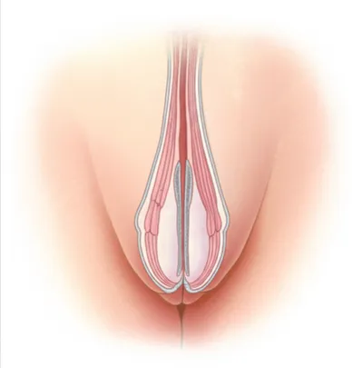 Illustration pump - Image 1