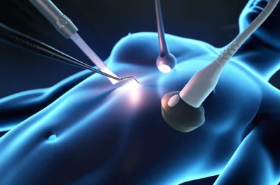 Illustration probes - Image 1