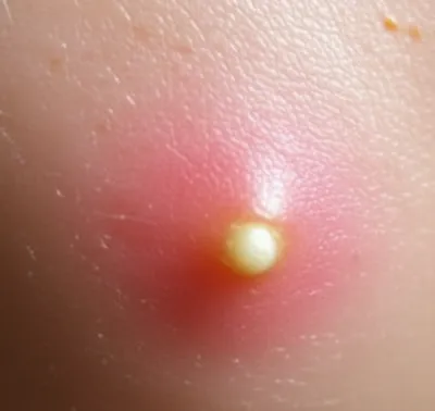 Illustration spots - Image 1