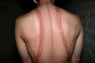 Illustration scourging