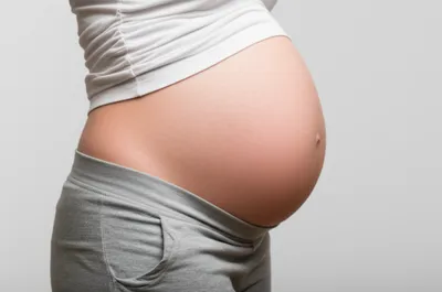 Illustration distended - Image 1