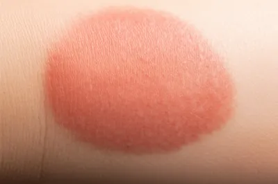 Illustration plaque - Image 1