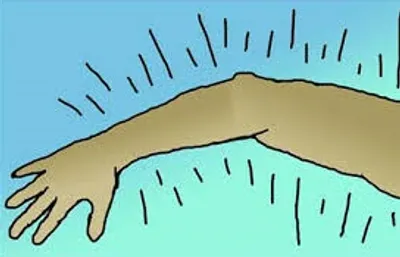 Illustration tingle - Image 2