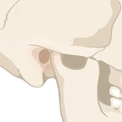 Illustration mastoid - Image 1