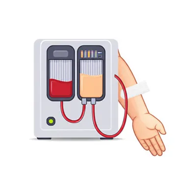 Illustration hemodialysis
