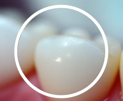 Illustration precarious - Image 1