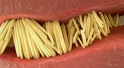 Illustration urates - Image 1