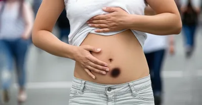 Illustration incontinent