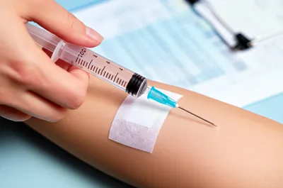 Illustration dosing - Image 1