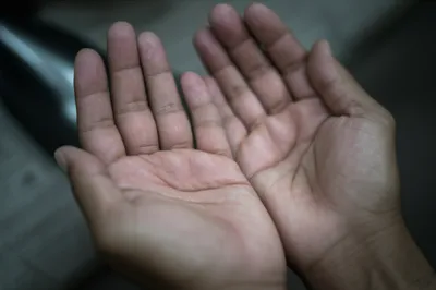 Illustration callused - Image 1