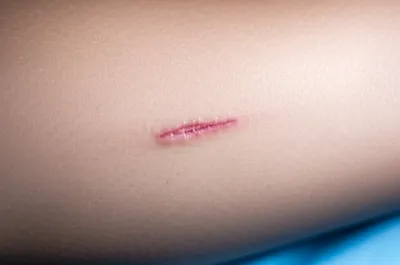 Illustration site - Image 1