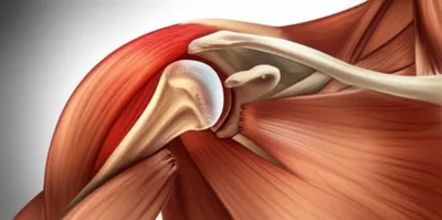 Illustration luxated