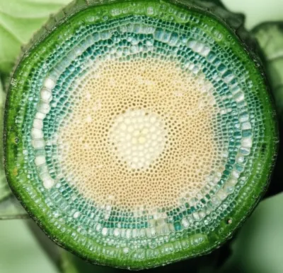 Illustration medulla - Image 1