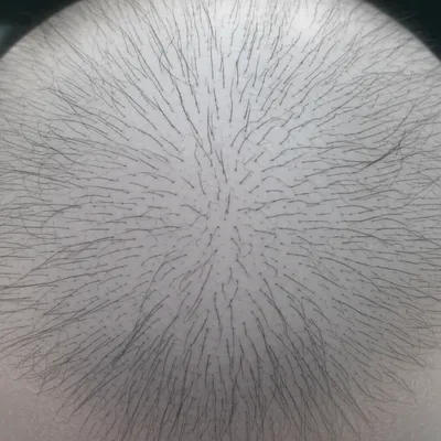 Illustration scalps - Image 1