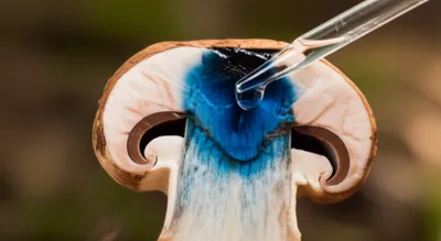 Illustration amyloid - Image 1