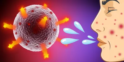 Illustration allergic - Image 1