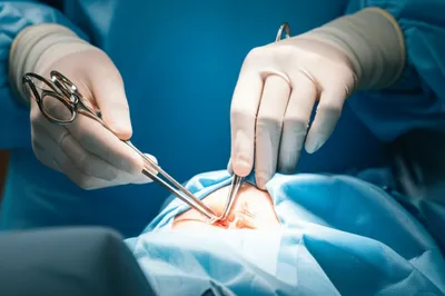 Illustration manoeuvres - Image 1