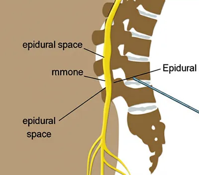 Illustration spinal