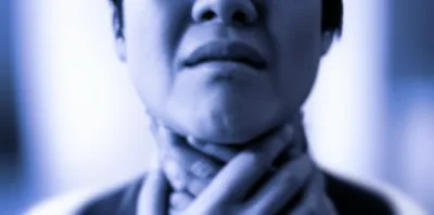 Illustration throttled - Image 1