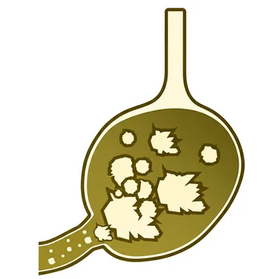 Illustration lithic - Image 1