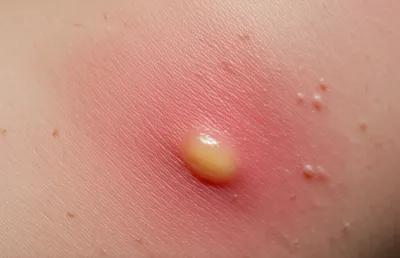 Illustration matters - Image 1