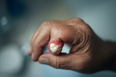 Illustration node - Image 1