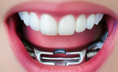 Illustration gag - Image 1