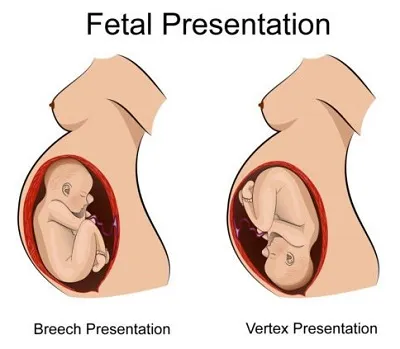 Illustration presentation - Image 2