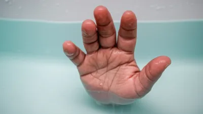 Illustration prunes - Image 1